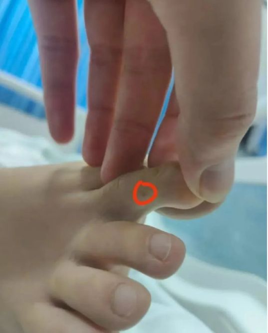 女子三亚旅游被蛇咬至身亡过程及进展：官方介入家属称或考虑尸检(图4)